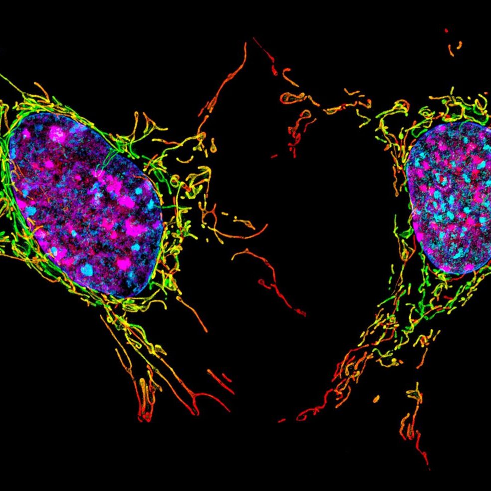 Fibroblast Fibroblast