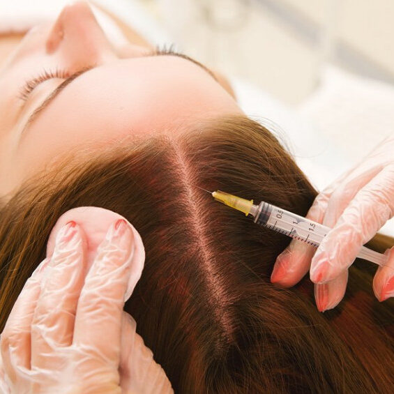 Saç Mezoterapisi Saç Mezoterapisi