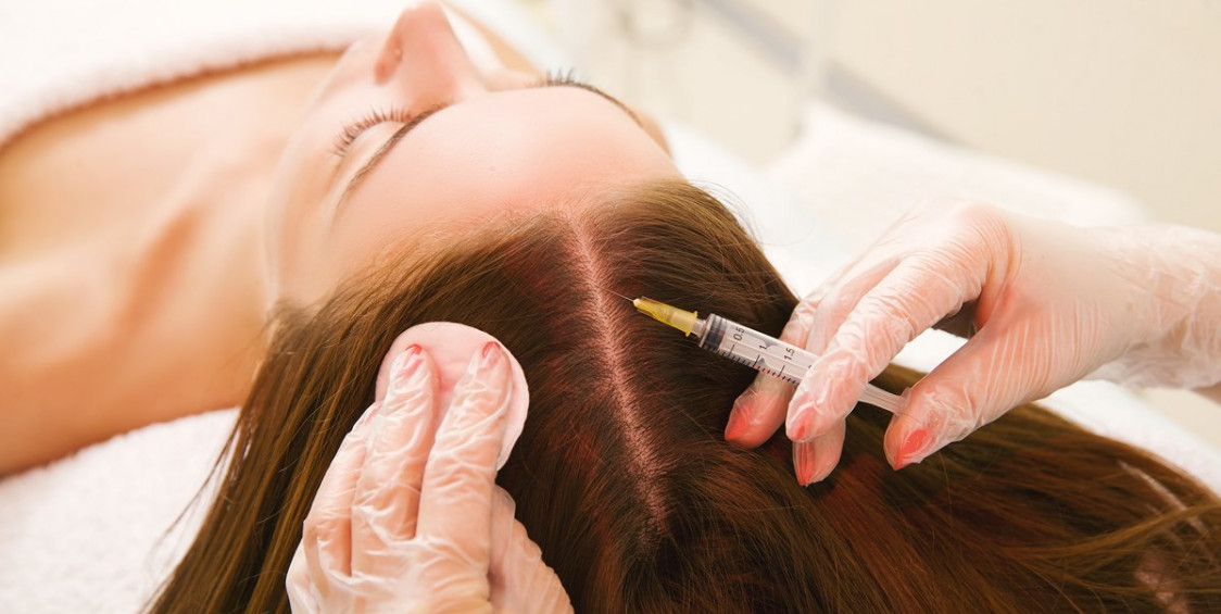 Saç Mezoterapisi Saç Mezoterapisi